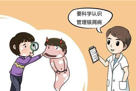 银屑病 牛皮癣
