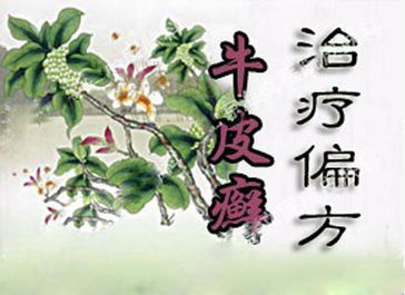 治疗牛皮癣的偏方有哪些